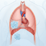 Cases settled. Read about our successful cases. thumbnail